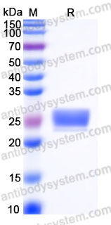 Recombinant Human CD94/KLRD1 Protein, N-His