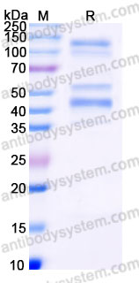 Recombinant Human DMP1 Protein, C-His