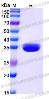 Recombinant Human BTN1A1 Protein, C-His