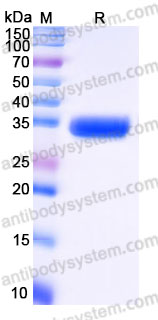 Recombinant Human MSLN/Mesothelin Protein, C-His