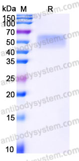 Recombinant Human LSAMP Protein, C-His