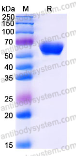 Recombinant Human MADCAM1 Protein, C-His
