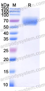 Recombinant Human CD218a/IL18R1 Protein, C-His