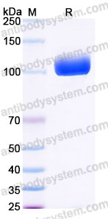 Recombinant Human SEMA5A Protein, C-His