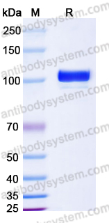 Recombinant Human ENPP2 Protein, C-His