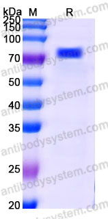 Recombinant Human GALNT3 Protein, C-His