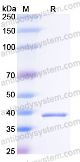 Recombinant Human HABP2 Protein, C-His