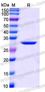 Recombinant Human PDIA5 Protein, C-His