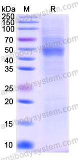 Recombinant Human IL11RA Protein, C-His