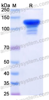 Recombinant Human KARS1/Lysyl-tRNA synthetase Protein, C-His