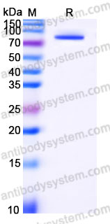Recombinant Human POSTN/OSF-2 Protein, C-His