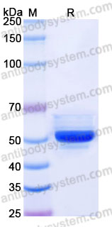Recombinant Human PDIA6 Protein, C-His
