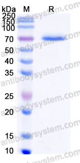 Recombinant Human CDSN Protein, C-His