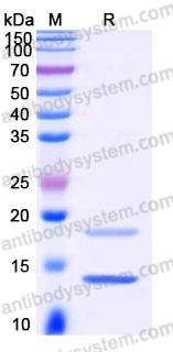 SDS-PAGE for Recombinant Human CST6 Protein, C-His ?>