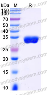 Recombinant Human IGFBP7 Protein, C-His