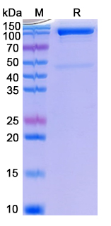 Recombinant Human DDB1 Protein, C-His