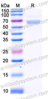 Recombinant Human PSG3 Protein, C-His