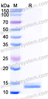 Recombinant Human CCL14/NCC-2 Protein, C-His