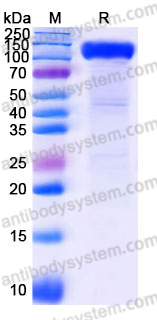 Recombinant Human AOC3/VAP-1 Protein, C-Fc