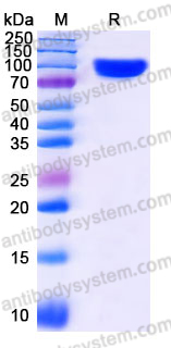 Recombinant Human AOC3/VAP-1 Protein, C-His