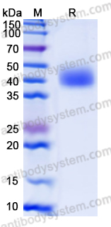 Recombinant Human MICB Protein, C-His