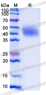 Recombinant Human MICB*00502 Protein, C-His