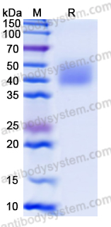 Recombinant Human MICA*00701 Protein, C-His