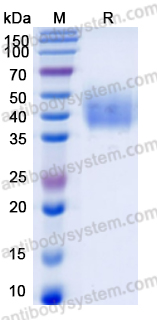 Recombinant Human MICA*027 Protein, C-His