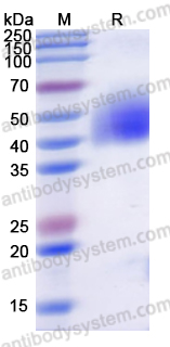 Recombinant Human MICA*009:02 Protein, C-His