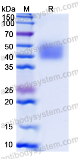 Recombinant Human MICA*011 Protein, C-His