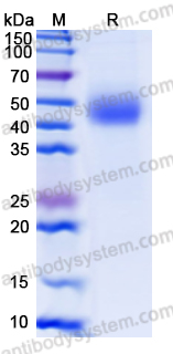 Recombinant Human MICA*019:01 Protein, C-His