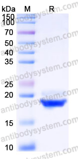 Recombinant Human CDNF Protein, C-His