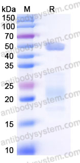Recombinant Human MUC17 Protein, C-His