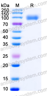 Recombinant Human VASN Protein, C-His