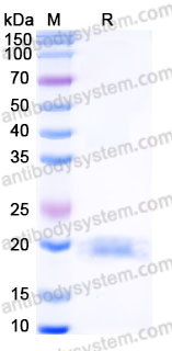 Recombinant Human CD306/LAIR2 Protein, C-His