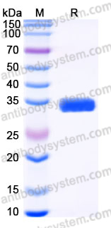 Recombinant Human IL27RA Protein, C-His