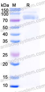 Recombinant Human OLFM4 Protein, C-10*His