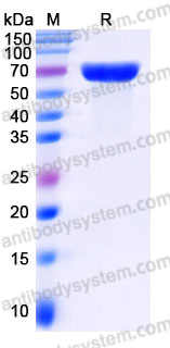 Recombinant Human CD300g/CD300LG Protein, C-His