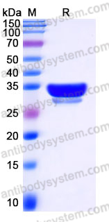 Recombinant Human IL29/IFNL1 Protein, C-10*His