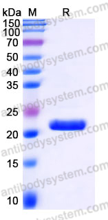 Recombinant Human IL28B/IL28C/IFNL3 Protein, C-His