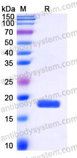 Recombinant Human IL28B/IL28C/IFNL3 Protein, Tag free