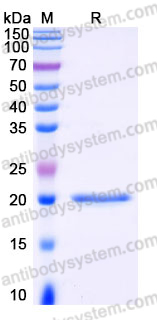 Recombinant Human IL28A/IFNL2 Protein, C-His