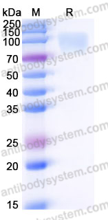 Recombinant Human IL17RC Protein, C-Flag-Fc