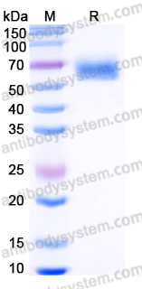 Recombinant Human IL17RD Protein, C-His