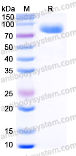 Recombinant Human IL17RD Protein, C-Fc