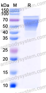Recombinant Human MUC16/CA125 Protein, C-His