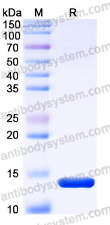 Recombinant Human CCL17/TARC Protein, C-His