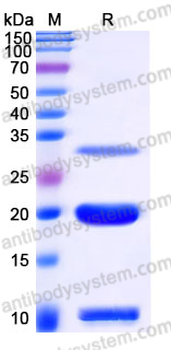 Recombinant Human KLK6 Protein, C-His