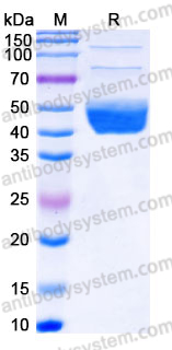 Recombinant Human IL22RA2 Protein, C-His