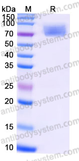 Recombinant Human CD365/KIM-1/TIM-1/HAVCR1 Protein, C-His